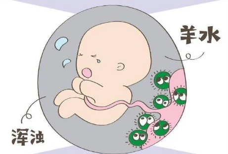 株洲助孕龙凤胎信息：浑浊的羊水对胎儿的影