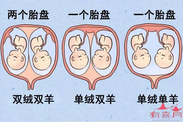 佛山供卵助孕双胞胎-山羊双胞胎单绒毛是什么意思？