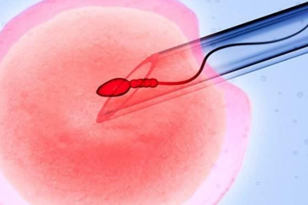 遵义借卵试管助孕：捐献精子的人工授精是什么意思？专家解释什么是捐赠精子的人工授精
